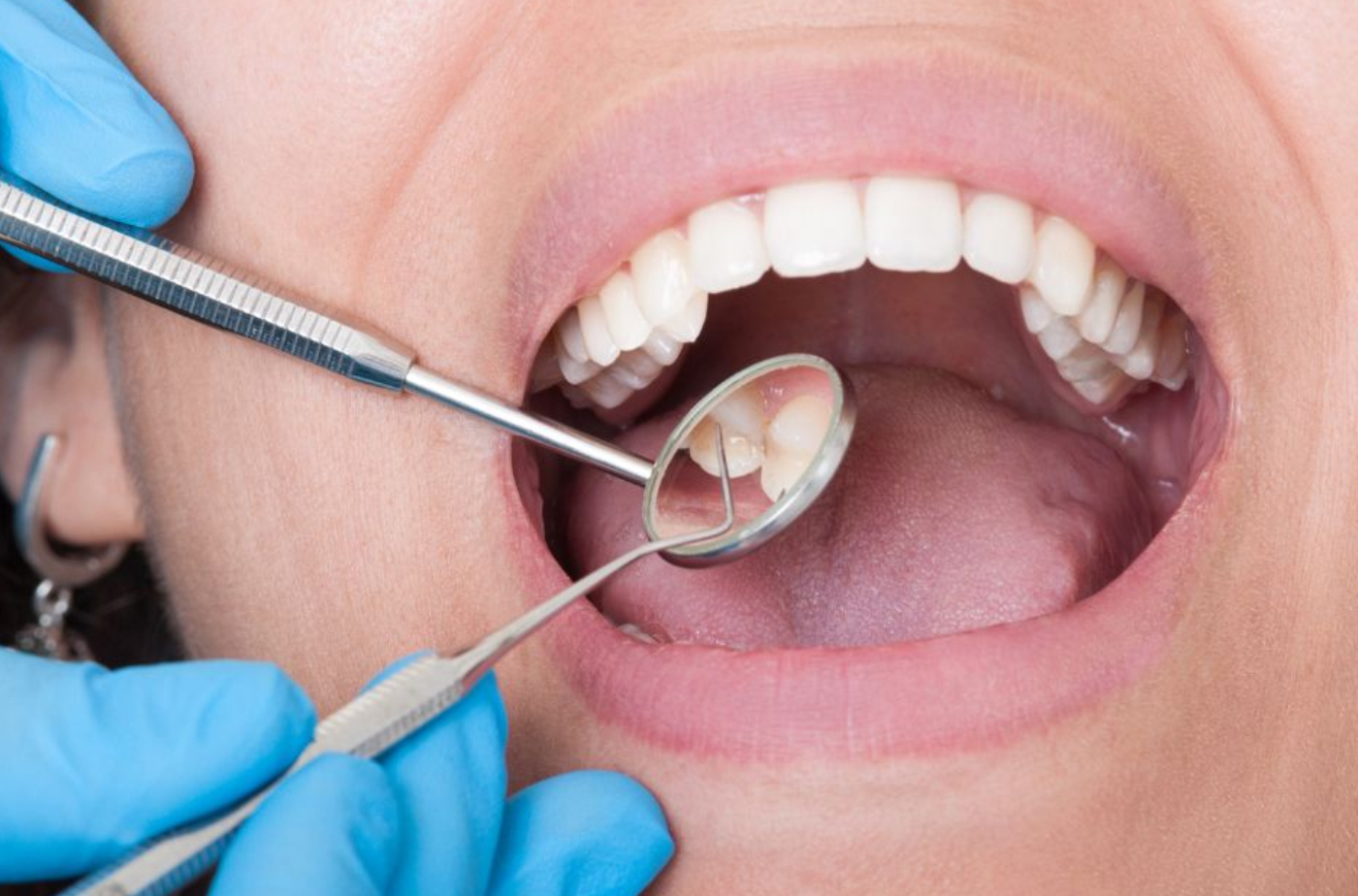 Amalgam