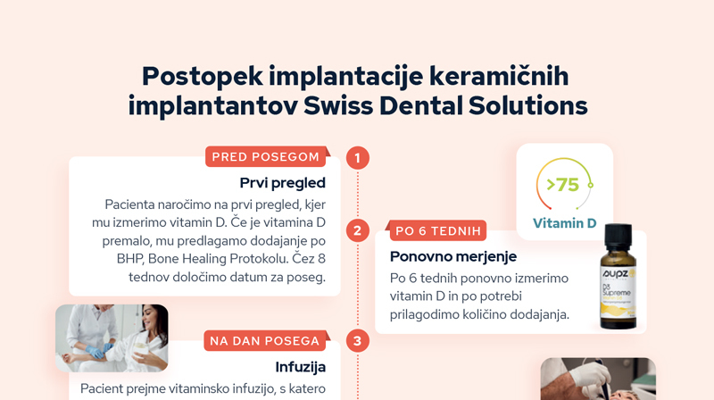 Postopek info sds